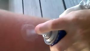 Plasztikai műtétre is szüksége lehet egy 10 éves kislánynak a veszélyes Tiktok kihívás miatt
